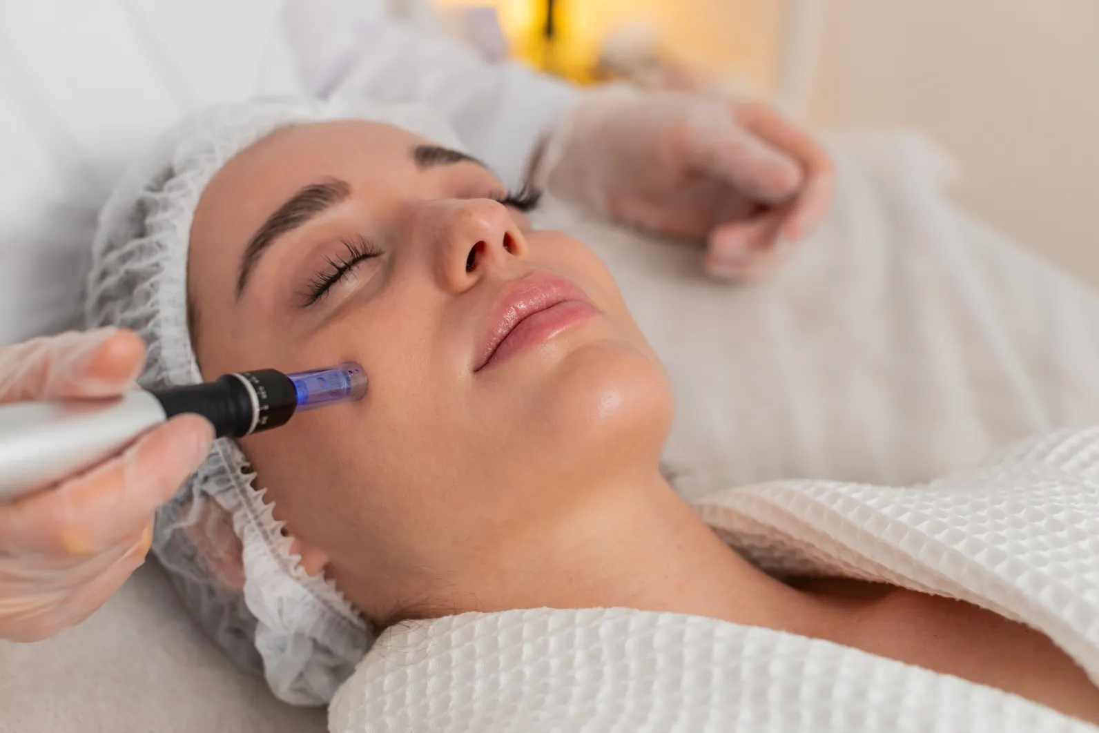 Microneedling-Weilheim-Schongau